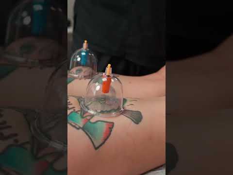 Deep massage of legs and thighs - vacuum cupping massage #deepmassage