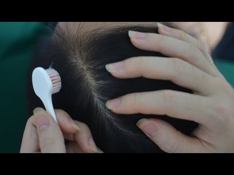 ASMR Aggressive Scalp Scratching, Scalp Massage Real Person, Sounds For Headache Relief Faster