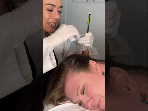 Asmr scalp 💆🏻‍♀️ #asmr #asmrsounds #asmrvideo #relax #relaxing #satisfying #hair #relax