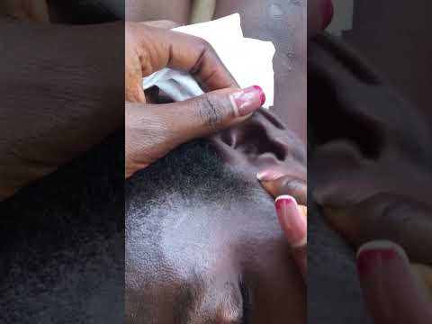 Best Ear Therapy To Help You Sleep #satisfying #tingling #asmrscratching #tinglyfeeling