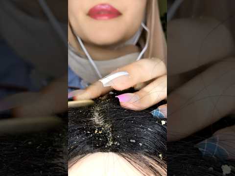 Dandruff Removal With Scalp Scratching 💆🏻‍♀️ #asmr #visualtingle #asmrmassage #shorts #canada
