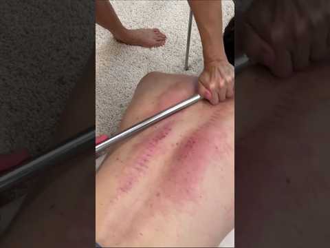 Most INTENSE CRACKS of His Life!  #chiropractor #asmr