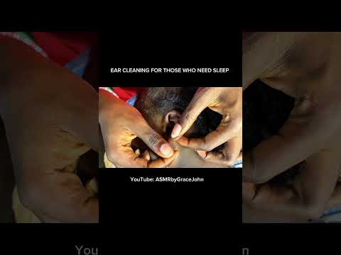 Asmr deep ear cleaning and nitpicking for sleep and relaxation