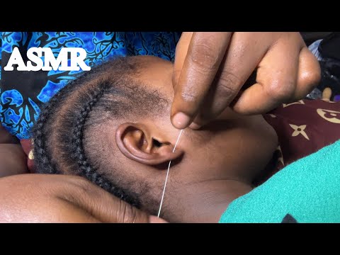 ASMR✨SATISFYING EAR CLEANING FOR PEOPLE WITH INSOMNIA 