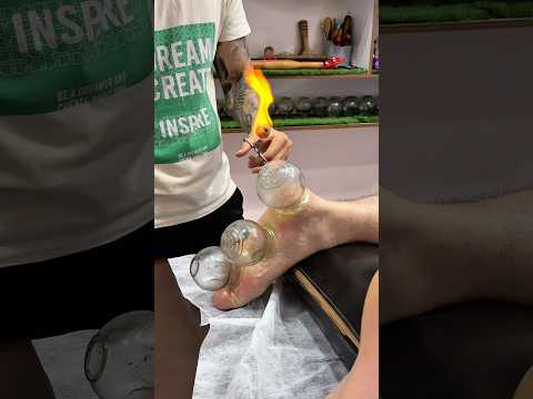 ASMR | Vip Cupping Alinezhad😍#relax #cupping #cuppingtherapy #asmr