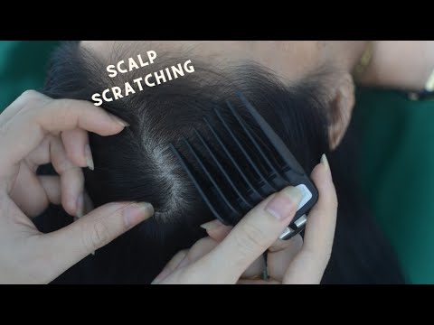 ASMR Scalp Scratching On Real Person, Sounds Of Scalp Massage, Sounds For Relieve Anxiety, Headache