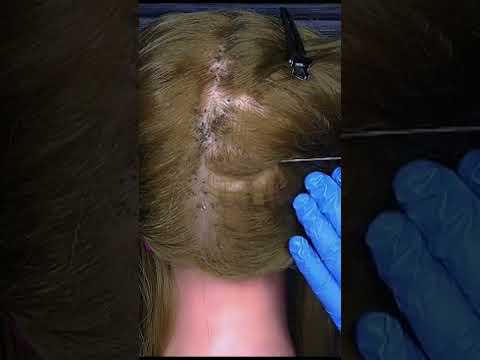 ASMR School Nurse Lice Check #shorts