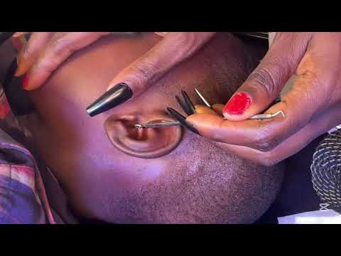 ASMR EAR CLEANING AND PICKING A QUICK SLEEP TRIGGERS FOR THOSE WHO HAVE INSOMNIA