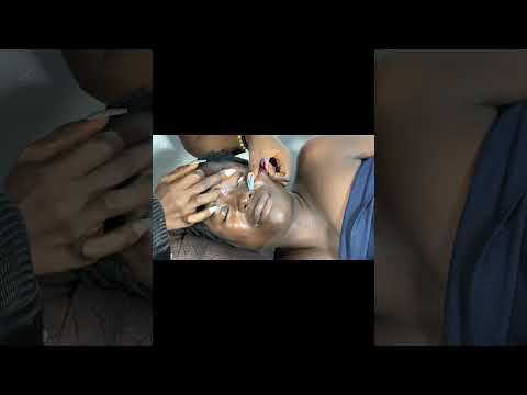 Ear Cleaning, Ear Eating & Licking, Mada Whisper Face Picking Scalp, Back Scratching Buccal Massage