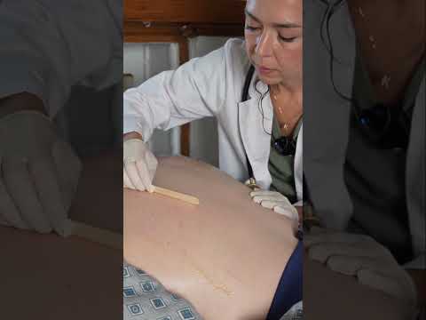 Asmr back exam #asmr #asmrsounds #asmrvideo #relaxing #relax #satisfying #satisfyingvideo #tingles