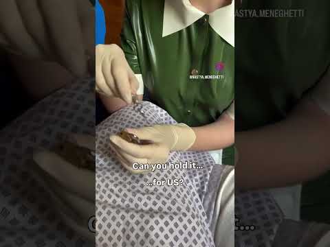 Can you hold it..? #medicalexam #nurse