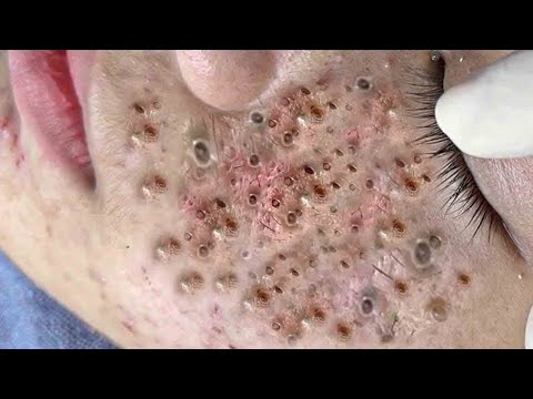حلول طبيعية لبشرة صافية# 𝐒𝐤𝐢𝐧 𝐂𝐚𝐫𝐞 99558