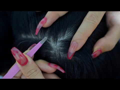 ASMR Scalp Check With Tweezers, Scalp Picking, Hair Treatment For Sleep