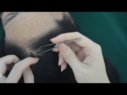 ASMR Hair Parting & Scalp Scratch, Real Person Scalp Massage For Stress Relief