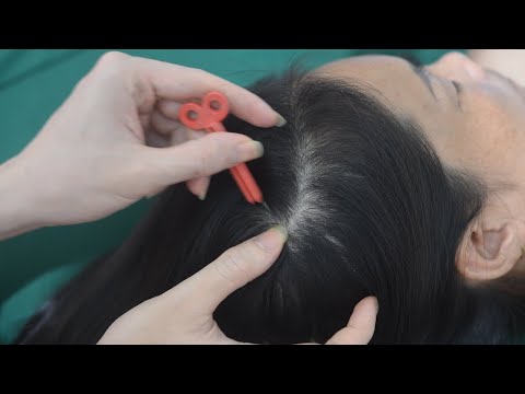 ASMR Nape Scratch Secrets Revealed You WON'T BELIEVE the Results