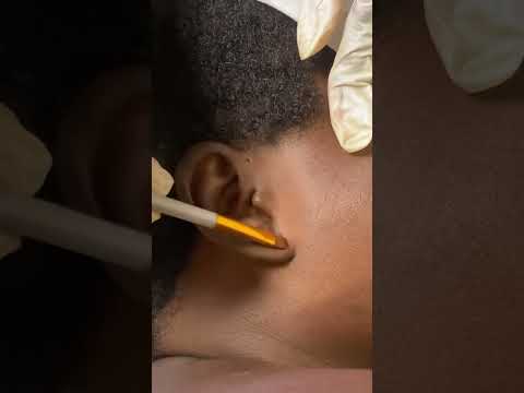 ASMR HOT WATER HEAD AND FACE MASSAGE, AGGRESSIVE SCALP SCRATCHING, EAR CLEANING AND PICKING, SLEEP