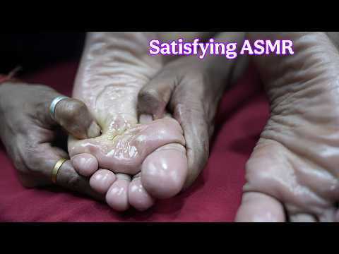 Midnight Clinic Session Deep Tissue Foot Massage For Better Sleep | ASMR Foot Rubbing & Scratching