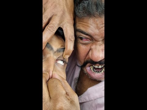 Demon King Asim Head Massage With Neck Crack And Hair Crack , Ear Cracking ASMR #shorts