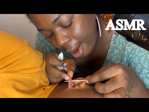 ASMR✨TOOTH PICKING MY SISTER’S EAR PIMPLES UNTIL SHE FELL ASLEEP 
