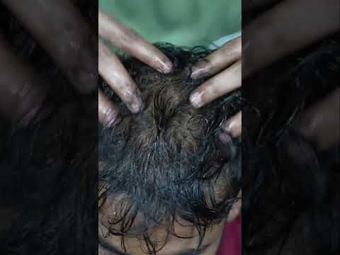 Deep Sleep Secrets: ASMR Head Massage Techniques for Restful Nights #shorts