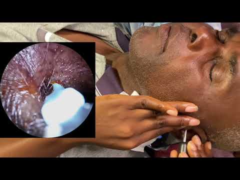 ASMR Instant Sleep Solution Cleaning Dad's Ears with Otoscope & Ear Hair Shaving | Relaxing ASMR