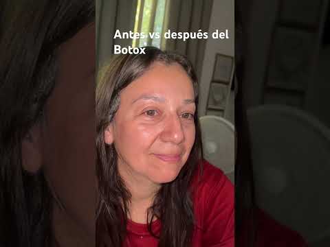 Antes vs después