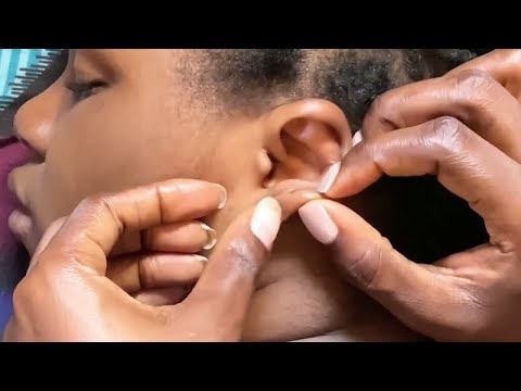 ASMR Ear Cleaning, Scalp Scratching & Back Scratching for Sleep back nitpicking 😴 Intense Tingles