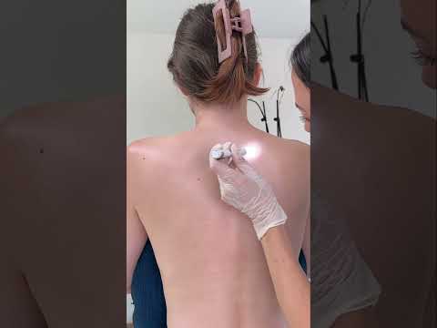 Asmr back exam #asmr #asmrsounds #asmrvideo #relaxing #relax #satisfying #satisfyingvideo #tingles