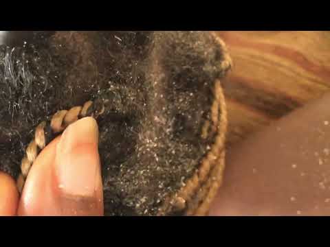 Asmr I promise To Give you The Best Scratch #asmr #scratch #dandruff