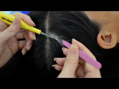 ASMR 1 Hour Scalp Check Bad Results / Scalp Scratching / Medical Scalp Treatment Relaxing For Sleep
