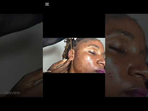 ASMR EAR CLEANING WITH GUM CHEWING IN YOUR EARS VERY RELAXING
