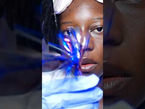 ASMR THERE’S SOMETHING IN YOUR EYE👁️ & ON YOUR FACE👀 DOUBLE TROUBLE PERSONAL ATTENTION #asmrshorts