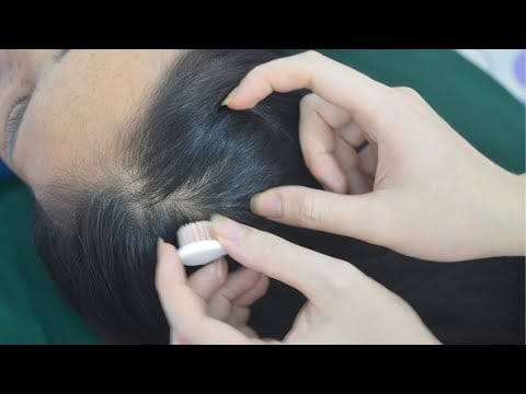 ASMR Hair Sound With Scalp Scratch Real Person, Tingly Sounds For Relaxation ( No Talking )