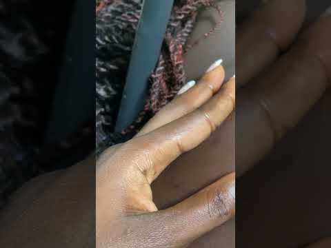 Asmr back nitpicking #satisfying #asmr #tingling #relax