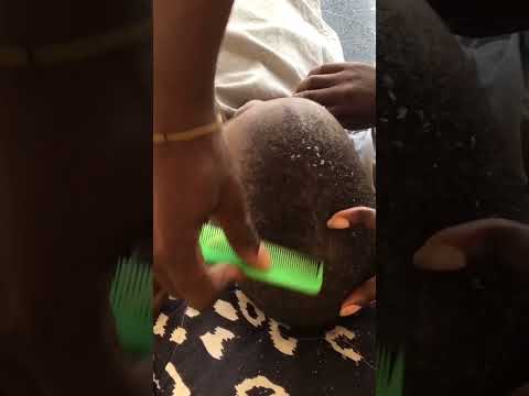 January 5, 2024. Dandruff scratch #asmrscratching #oddlysatisfying #hair #headscratches #dandruff