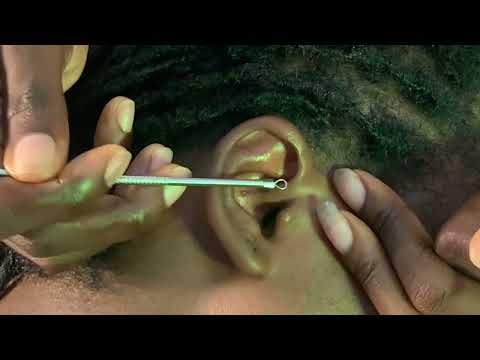 Deep Sleep ASMR - Ear Cleaning, Scalp Scratching, face picking Back Massage & Armpit Massage