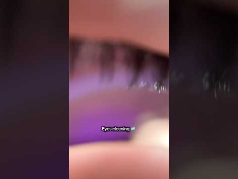 ASMR eyes cleaning #asmr #asmrsounds #asmrrelax #asmrsleep #relax #tingles #asmrvideo #relaxingvideo
