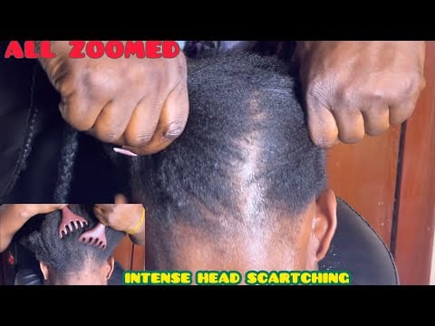 ASMR✨ALL ZOOMED INTENSE HEAD SCRATCH, NIT PICK, INTENSE NAPE MASSAGE AND HAIR PULLING WITH GUM.