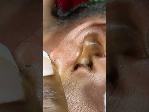 Asmr deep ear cleaning- A lot of tingles #relax #asmr #tingling #satisfying #tinglyfeeling