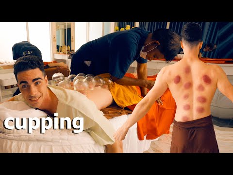 ASMR: Triplo Massaggio CINESE ai Piedi con COPPETTAZIONE col FUOCO e GUASHA!