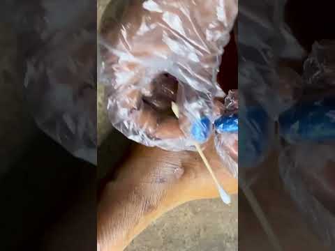 Asmr luxury effective leg massage and treatment #relaxing #tinglyfeeling #satisfying #legs