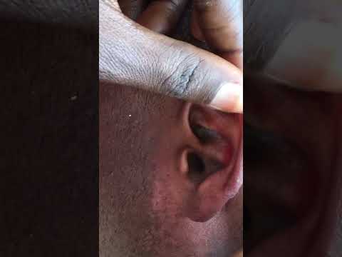 Good time to relax and sleep #satisfying #asmr #nitpicking #asmrsound