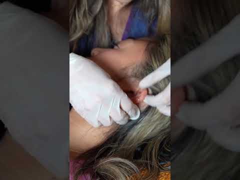 Asmr ear 👂 exam #asmr #relax #relaxing #asmrsounds #asmrvideo #tingles #medical #satisfying #sleep