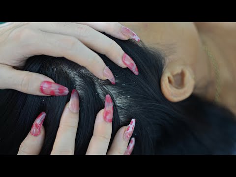 ASMR Real Person Scalp Check, Scalp Scratching, Scalp Massage For Your Sleep