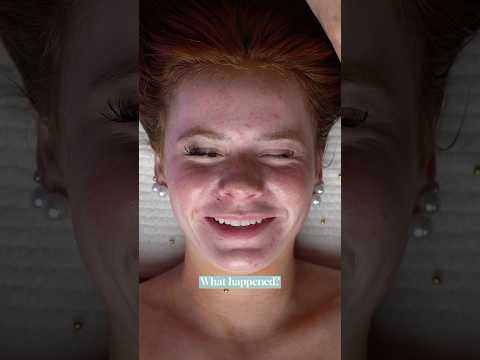 ASMR Jelly Mask with Harper Zilmer