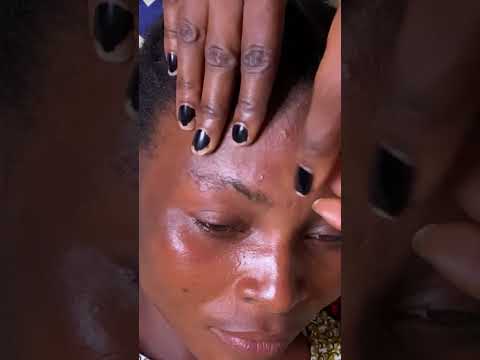 Asmr face Nitpicking #satisfying #tingling #nitpicking #skincare #relaxingtriggers