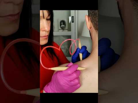Weird & special shoulder tests