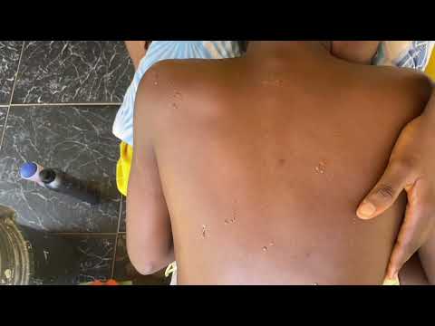 ASMR GIVING MY NEICE A RELAXING BODY MASSAGE, EAR CLEANING, SCALP SCRATCHING