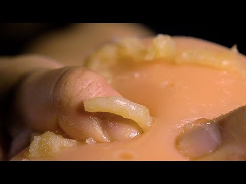 [ASMR] Squeeze out acne pus (subtitles, more than you can imagine, amateur)