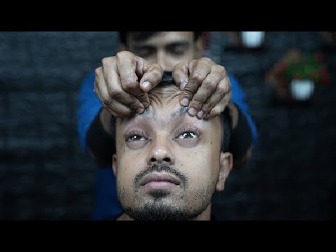 Watch For Relief Headache | ASMR Indian Barber Best Forehead Tapping Massage | Scratching ASMR